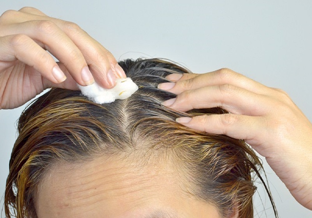 Hair Transplant